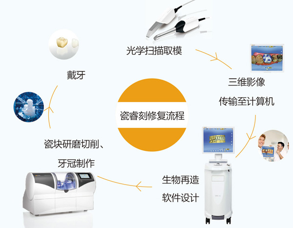 引進(jìn)瓷?？桃闻孕迯?fù)系統(tǒng)并順利投入使用