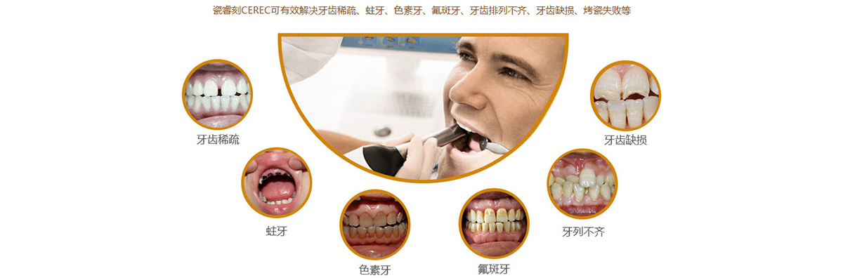 經(jīng)歷人間煉獄才知道瓷?？萄例X修復(fù)黑科技